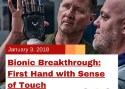 Bionic Breakthrough: First Hand with Sense of Touch